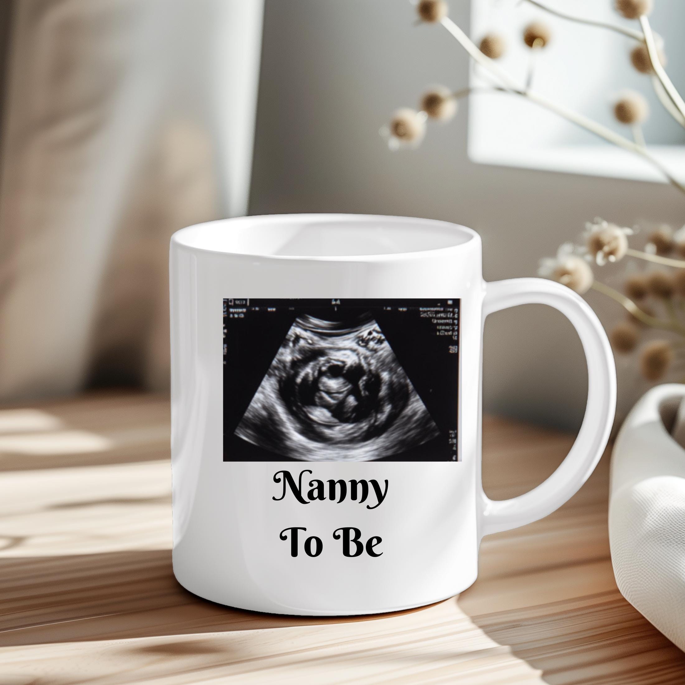 Personalized Baby Scan Mug: Ultrasound Photo Gift, Mummy/Daddy/Grandparent